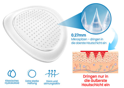 🧬KUBOZN® Mikronadel-Pflaster gegen Gelenkschmerzen & Entzündungen (Offer)