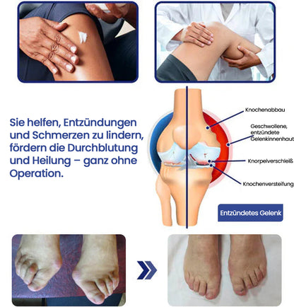 ✅Offiziell empfohlen: KUBOZN® Magnesium-Intensivcreme gegen Gelenk- und Nervenschmerzen (bei Arthrose, Neuropathie, Rheuma, Sportverletzungen u. v. m.)