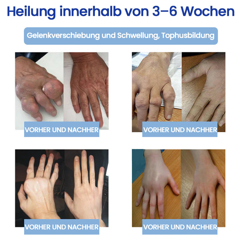 ✅Offiziell empfohlen: KUBOZN® Magnesium-Intensivcreme gegen Gelenk- und Nervenschmerzen (bei Arthrose, Neuropathie, Rheuma, Sportverletzungen u. v. m.)