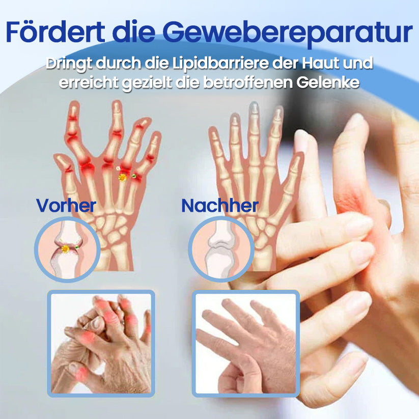 ✅Offiziell empfohlen: KUBOZN® Magnesium-Intensivcreme gegen Gelenk- und Nervenschmerzen (bei Arthrose, Neuropathie, Rheuma, Sportverletzungen u. v. m.)