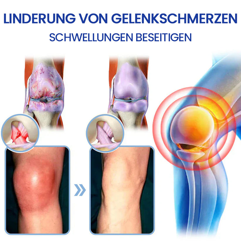 ✅Offiziell empfohlen: KUBOZN® Magnesium-Intensivcreme gegen Gelenk- und Nervenschmerzen (bei Arthrose, Neuropathie, Rheuma, Sportverletzungen u. v. m.)