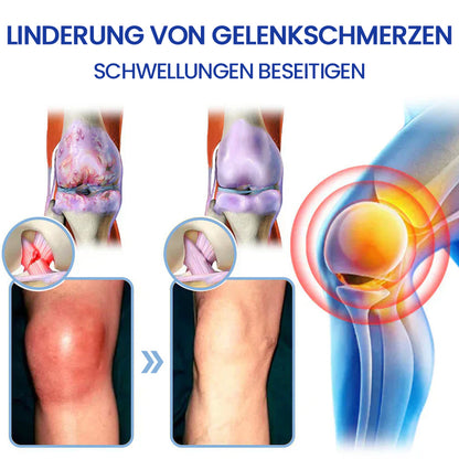 ✅Offiziell empfohlen: KUBOZN® Magnesium-Intensivcreme gegen Gelenk- und Nervenschmerzen (bei Arthrose, Neuropathie, Rheuma, Sportverletzungen u. v. m.)