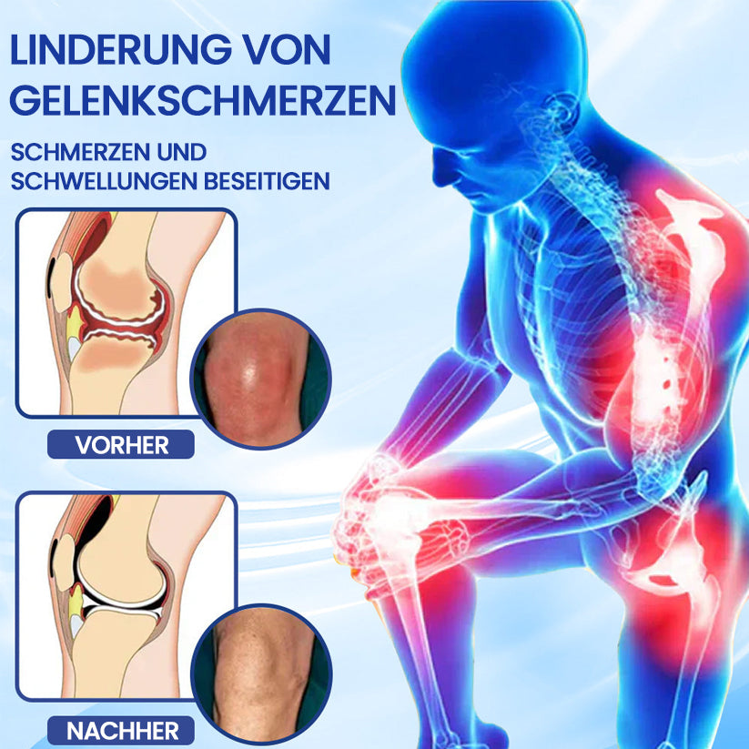 ✅Offiziell empfohlen: KUBOZN® Magnesium-Intensivcreme gegen Gelenk- und Nervenschmerzen (bei Arthrose, Neuropathie, Rheuma, Sportverletzungen u. v. m.)
